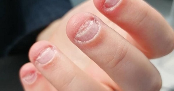 Почему люди кусают ногти? Почему люди кусают ногти?