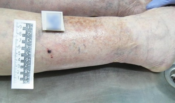 В Беларуси змея укусила на даче пенсионерку. Она умерла В Беларуси змея укусила на даче пенсионерку. Она умерла
