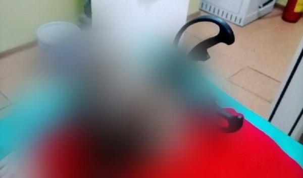 Следователи установили обстоятельства причинения тяжких телесных повреждений 12-летней девочке. Ей ножницы в шею воткнула собственная мать во время пьянки Следователи установили обстоятельства причинения тяжких телесных повреждений 12-летней девочке. Ей ножницы в шею воткнула собственная мать во время пьянки