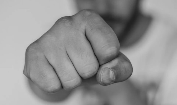 Жителю Бреста выбили два зуба. Вот что произошло Жителю Бреста выбили два зуба. Вот что произошло
